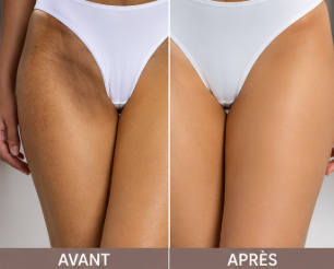 Résultat avant après savon Alada